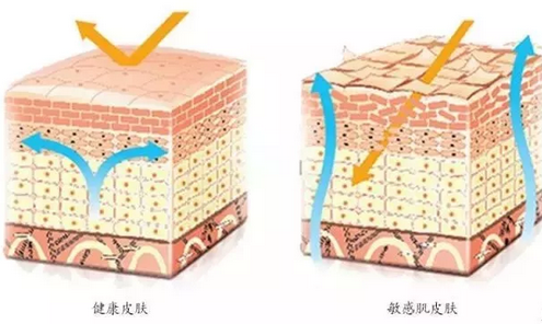 敏感肌膚與健康肌膚的對比 敏感肌膚與健康肌膚的對比,導(dǎo)致肌膚敏感的原因有哪些