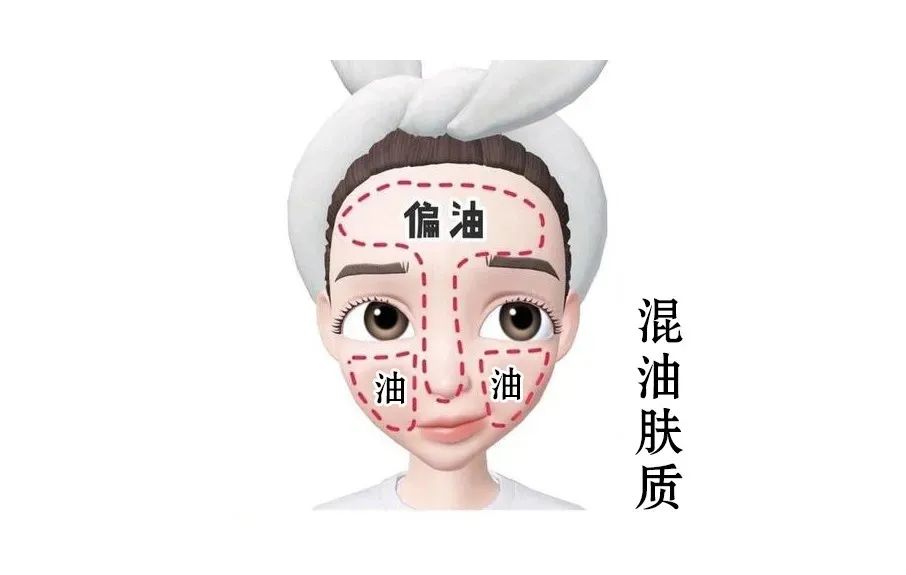 混合性偏油皮膚 混合性皮膚如何護理效果好?