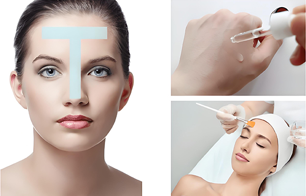 什么是刷酸？刷酸有什么好處？刷酸的好處有哪些？