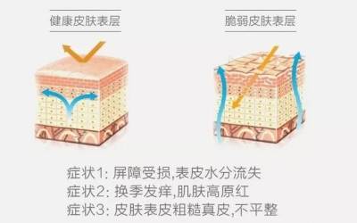 敏感肌與過(guò)敏肌的區(qū)別是什么？