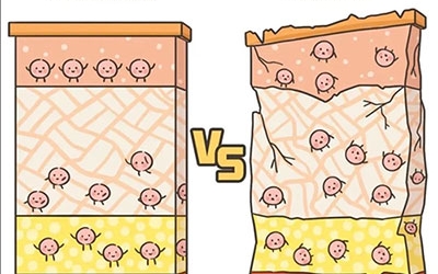 敏感性皮膚產(chǎn)生的原因是什么？